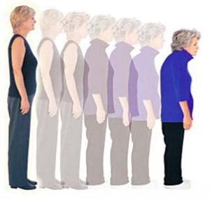 cara mencegah osteoporosis