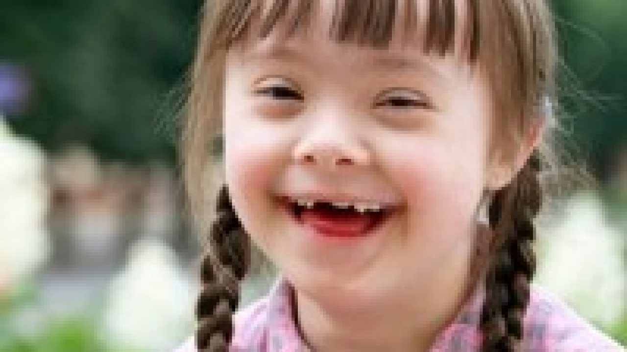 4 Penyebab Down Syndrome Ciri Dan Pemeriksaannya Halosehat