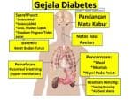 gejala-diabetes