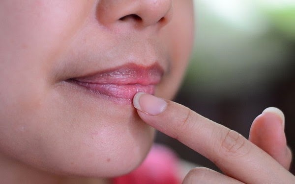 Bibir Gelap dan Kering? Jangan-jangan 12 Kebiasaan Ini Penyebabnya Lho