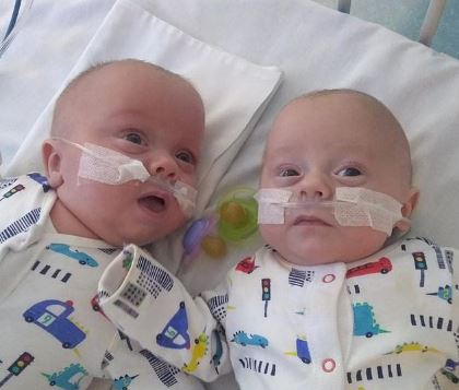 Bayi Kembar Laki-laki Terkecil di Dunia dengan Bobot 450 Gram Lahir di Inggris
